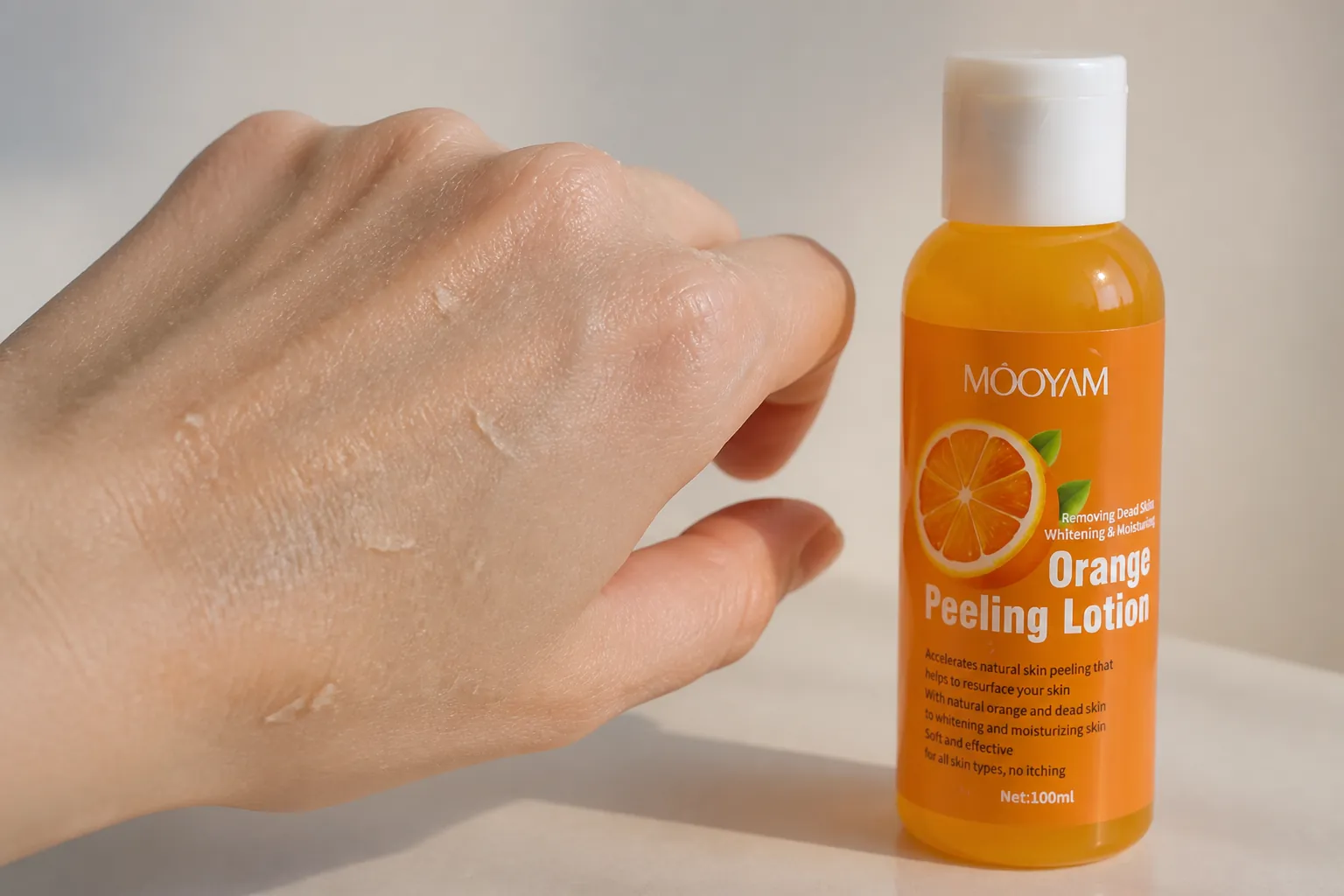 Elegant hand showing visible dry flaky skin particles on the surface with dry skin detail